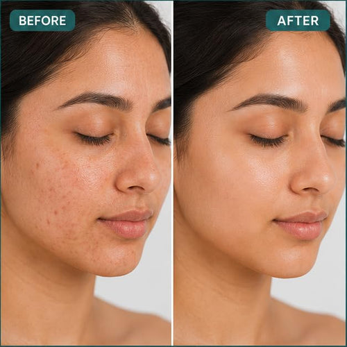 Nuvique 0.2% Retinol Cream with Squalane & Ceramides 50g | Evening Face Cream for Smoother Looking Skin